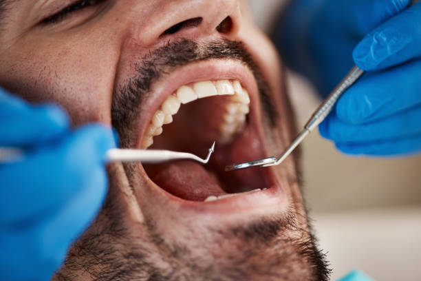 Best Emergency Treatment for Toothache in Tigerville, SC